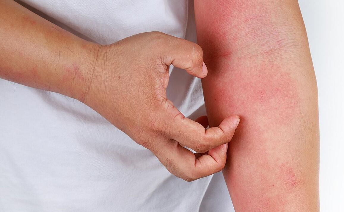 moguće komplikacije od korištenja sode